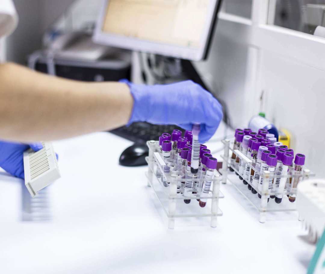 Analyse von Blutproben